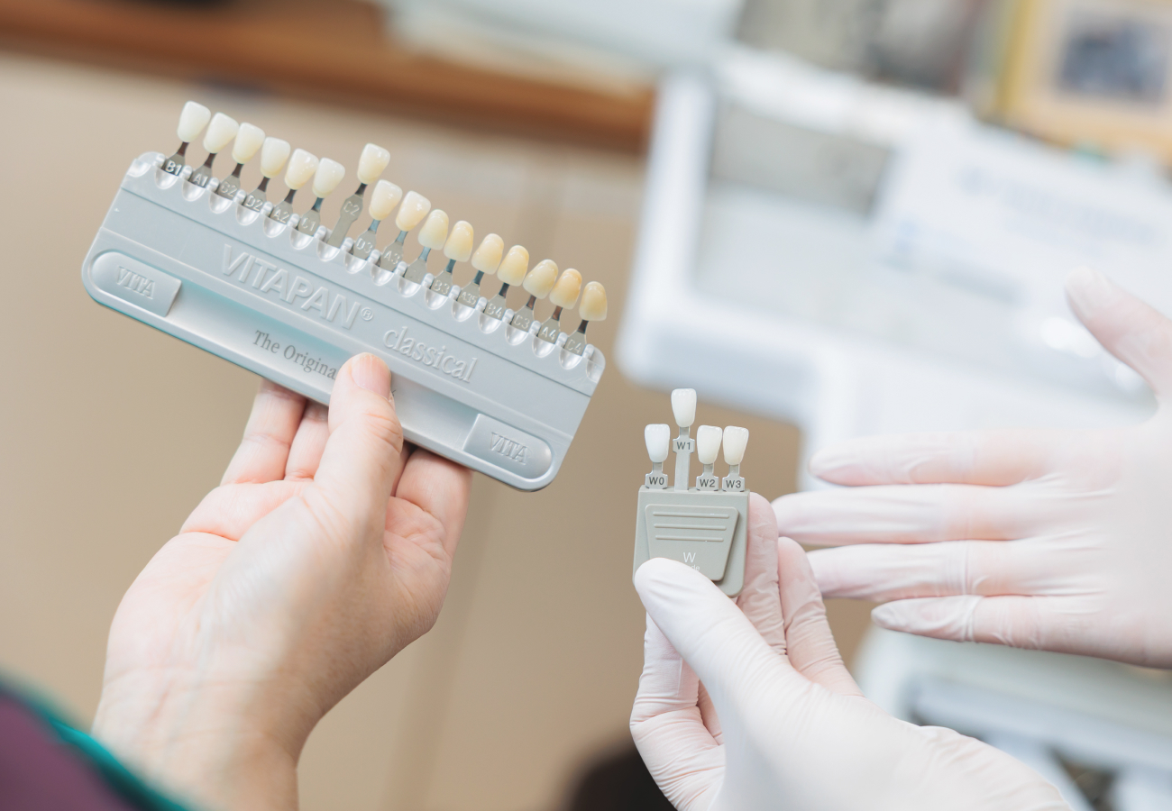 ホワイトニングについて